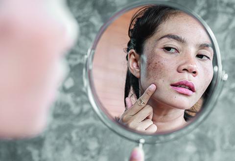 How to Identify Skin Discoloration
